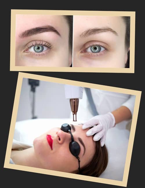 Чому видаляють перманентний макіяж