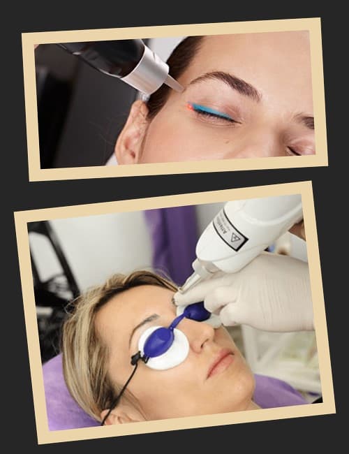 Чому доводиться видаляти татуаж?