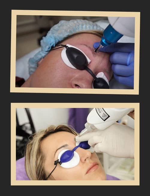 Чи варто видаляти невдалий татуаж