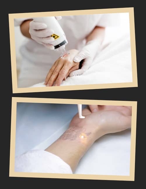 Причини зведення татуювань