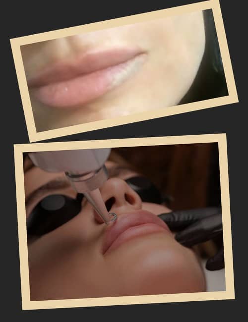 Особливості лазерної обробки