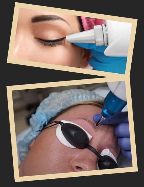 Найефективніший метод, як прибрати перманентний макіяж