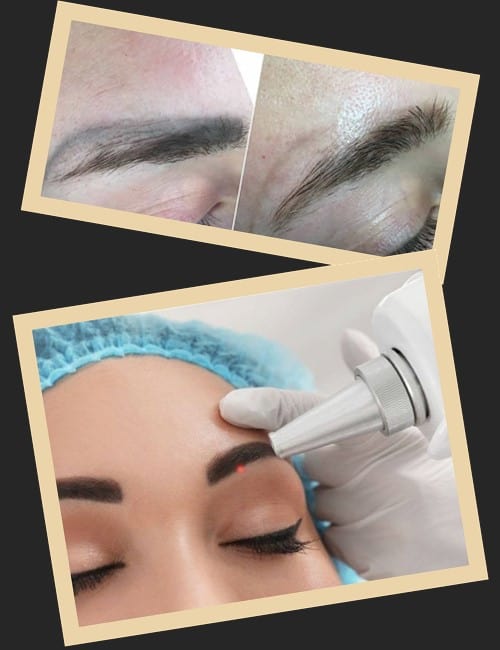 методи для виведення татуажу