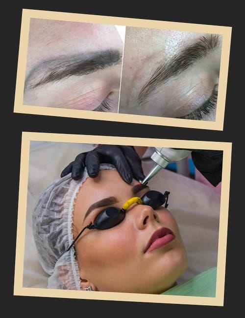 вивести невдалий татуаж брів