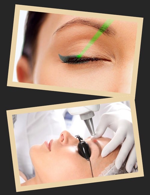 Чому найчастіше використовується лазер