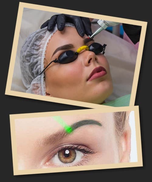 повне видалення татуажу брів