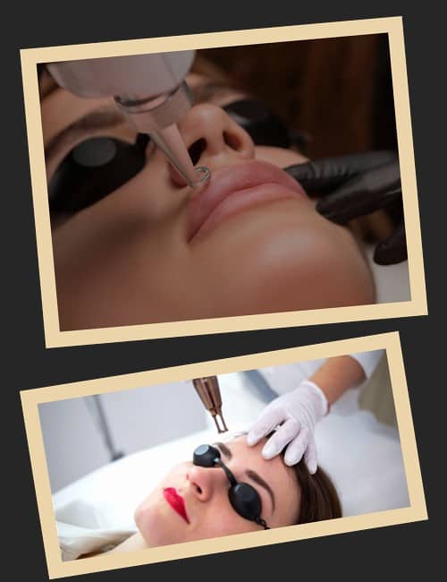 виведення перманентного макіяжу лазером