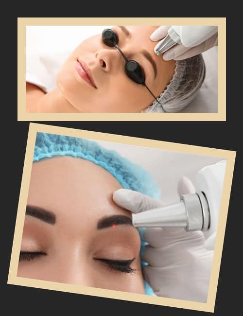 Лазерний метод видалення перманентного макіяжу очей