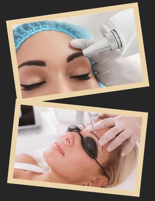 Процедура лазерного видалення перманентного макіяжу