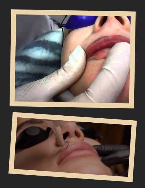 видалення перманентного макіяжу в Києві