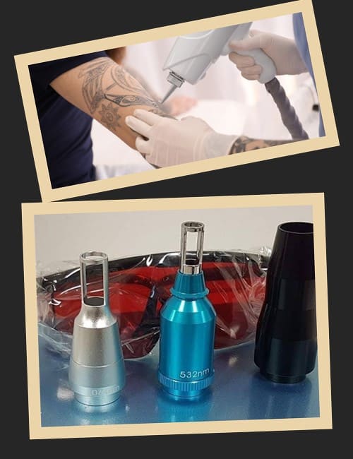 Метод лазерного виведення тату