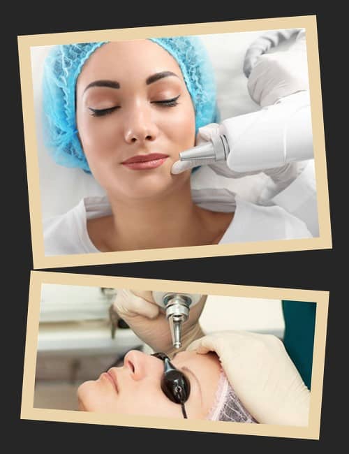 перевага лазерного видалення татуажу