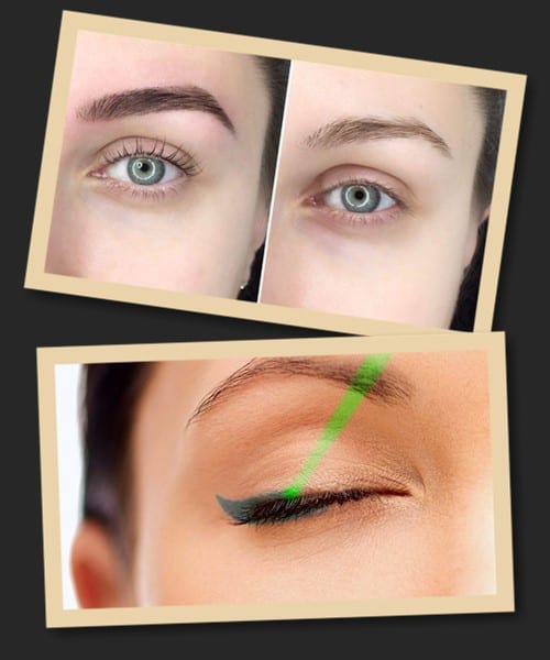 Звести татуаж лазером у Києві