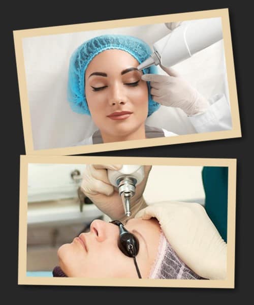 видалення перманентного макіяжу