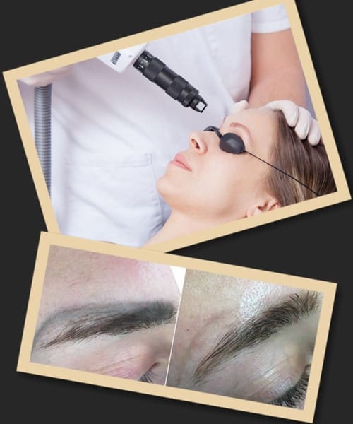 результат від виведення татуажу брів