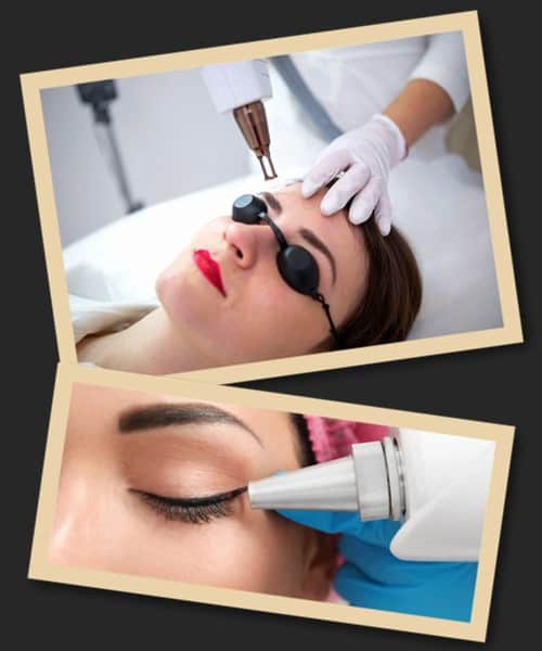 Як вивести татуаж очей