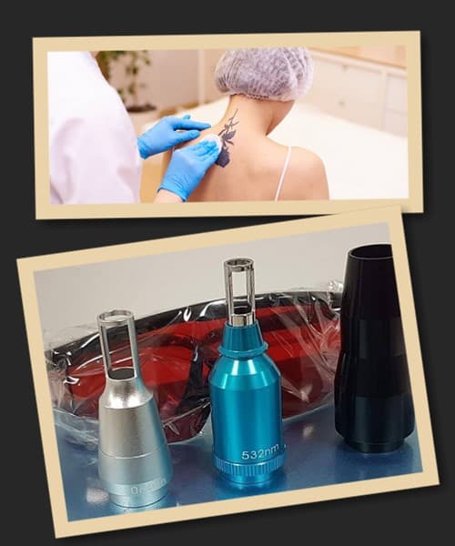 Чим цікавий пікосекундний лазер Picosure