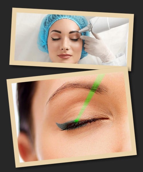 Видалення перманенту лазером