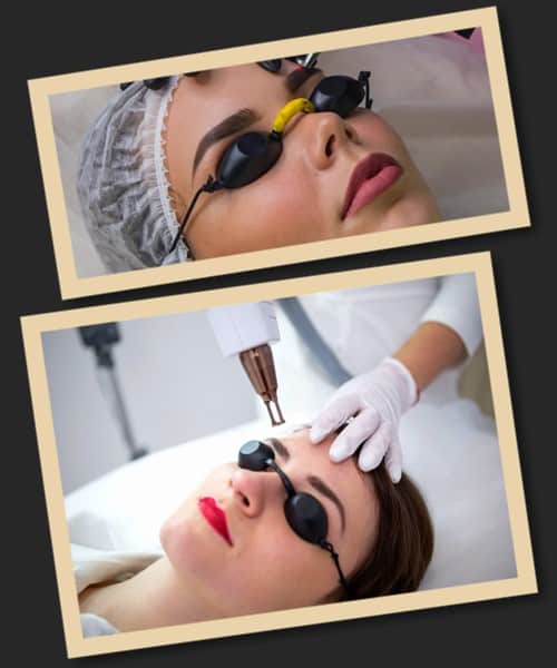 Чинники, що впливають на якісне видалення татуажу