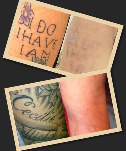 Способи виведення татуювань