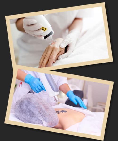 зведення татуювання