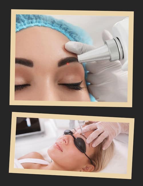 Скільки коштує видалити татуаж брів?