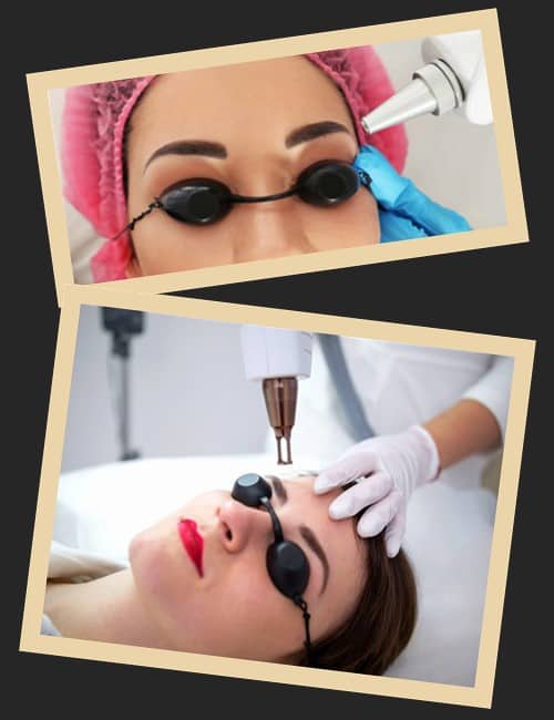 Лазерне видалення татуажу