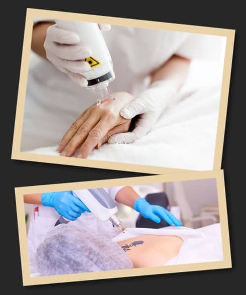 Вивести татуювання ціна