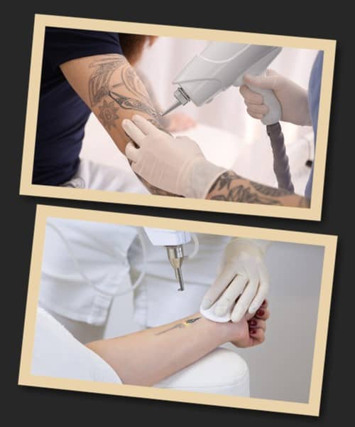 Як можна вивести татуювання