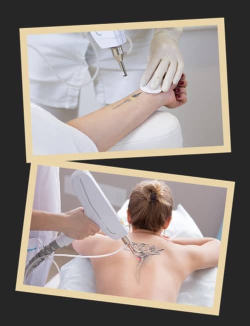 Де вивести татуювання у Києві