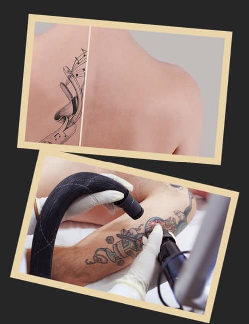 звести тату