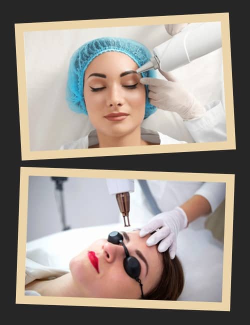 Способи видалення татуажу