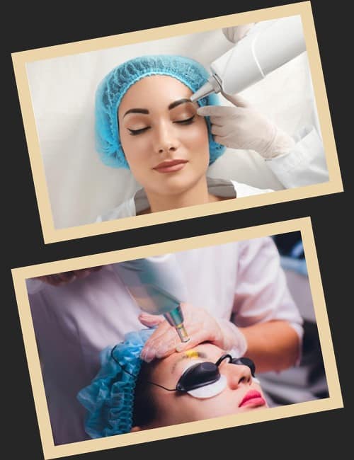 видалити татуаж