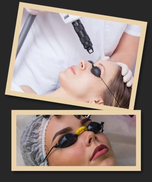 Як позбутися татуажу брів раз і назавжди