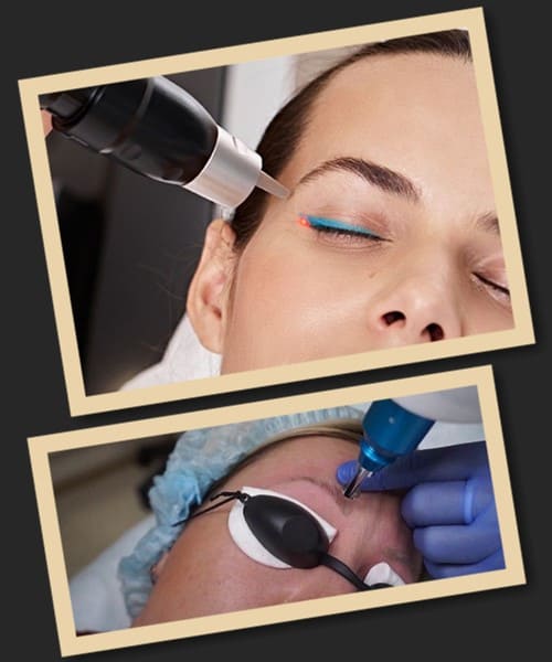 методи виведення татуажу брів та стрілок