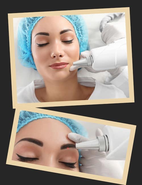 Лазерне видалення татуажу