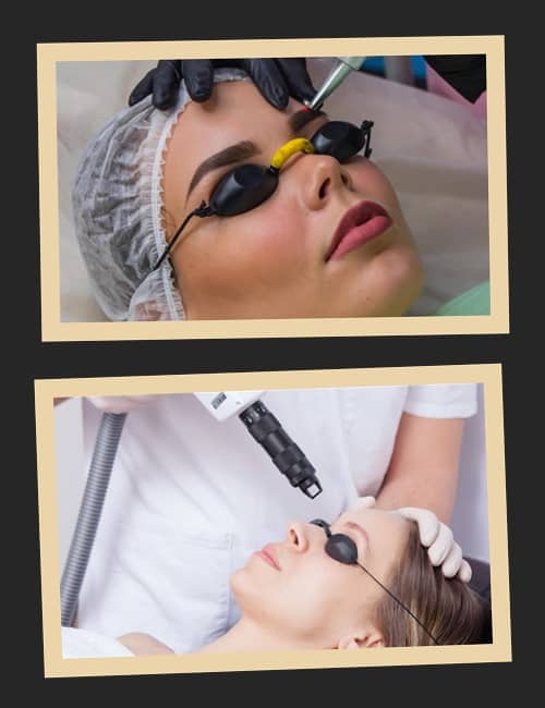 Видалення татуажу неодимовим лазером – найсучасніший та найбезпечніший спосіб