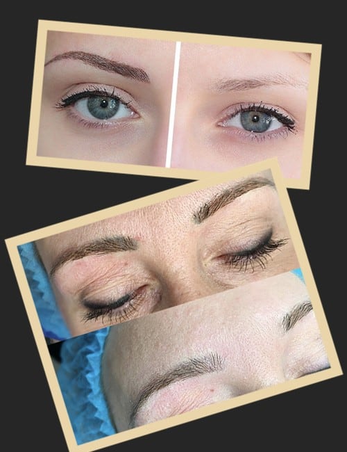 Результативність виведення татуажу ревумером