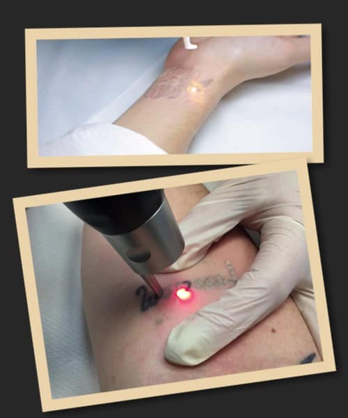 Щоб вивести татуювання