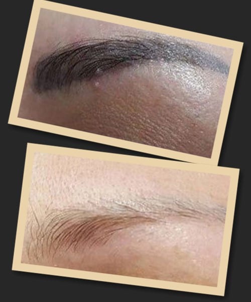 Хімічний метод видалення перманентного макіяжу