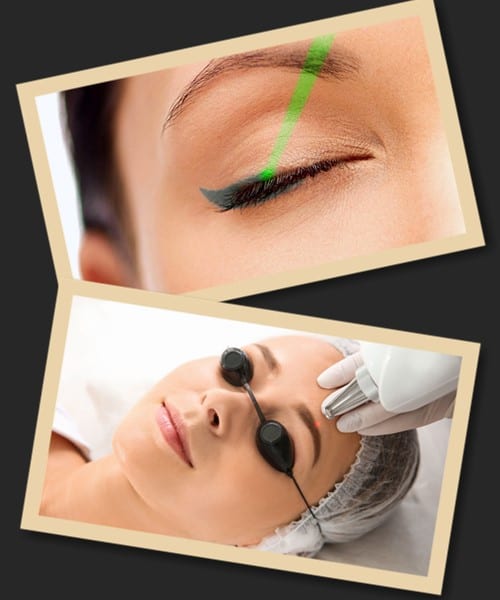 У лазерного методу виведення татуажу