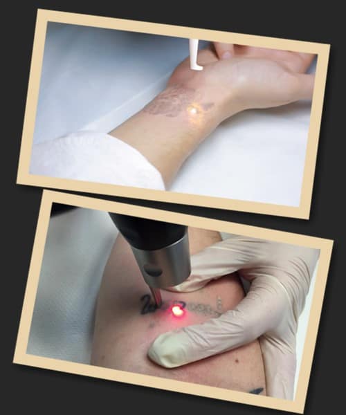 Як працює лазер