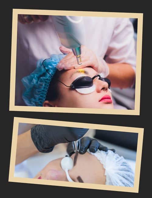 Вартість видалення татуажу брів