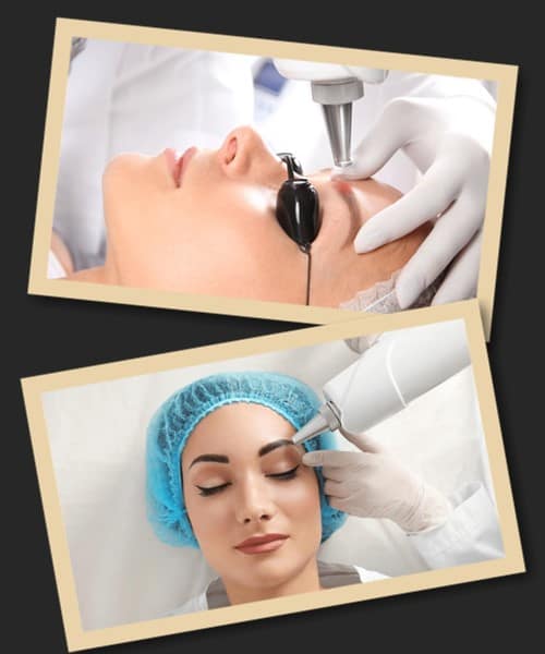 Як відбувається виведення татуажу брів лазером