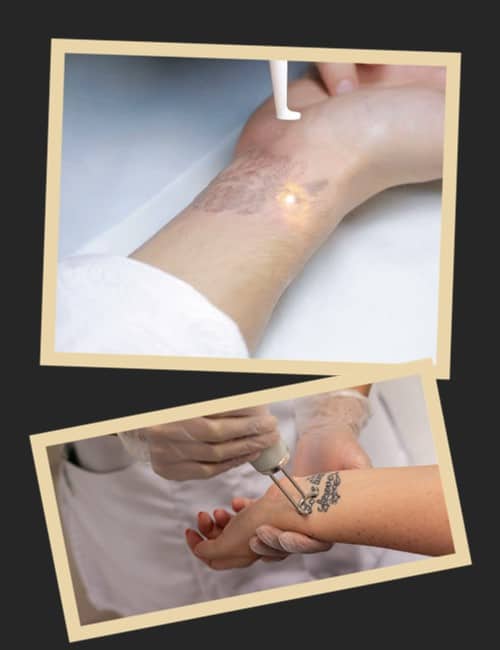 вивести татуювання