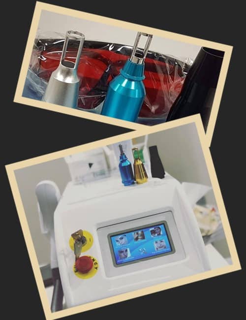 Лазерне виведення тату