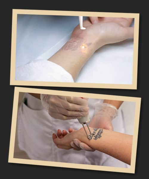 як вивести тату