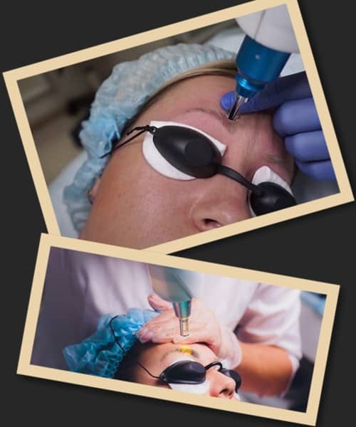 видалення перманенту брів