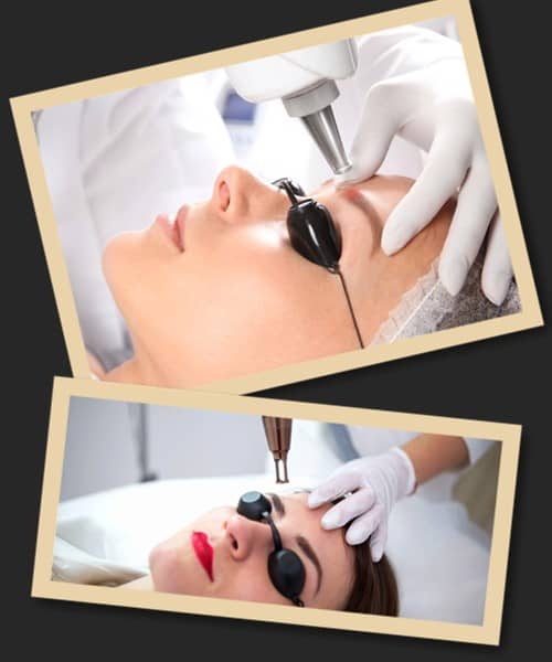 Як відбувається виведення татуажу