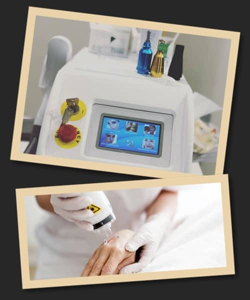 Чому лазерний метод вважається найкращим?